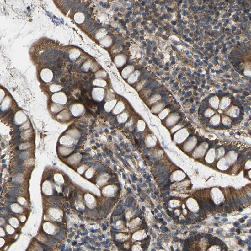 Anti-C21orf91 Antibody