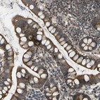 Anti-C21orf91 Antibody