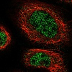 Immunofluorescent staining of human cell line A-431 shows localization to nucleoplasm & cytosol.