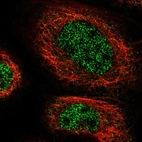 Immunofluorescent staining of human cell line A-431 shows localization to nucleoplasm & cytosol.