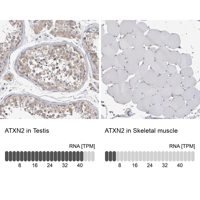 Anti-ATXN2 Antibody