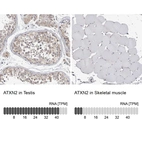 Anti-ATXN2 Antibody