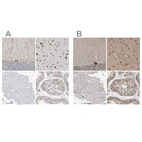 Immunohistochemical staining of human cerebellum, cerebral cortex, skeletal muscle and testis using Anti-ATXN2 antibody HPA018295 (A) shows similar protein distribution across tissues to independent antibody HPA020339 (B).