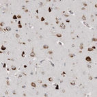 Immunohistochemical staining of human cerebral cortex shows moderate to strong cytoplasmic positivity in neurons.