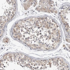 Immunohistochemical staining of human testis shows moderate cytoplasmic positivity in cells in seminiferous ducts.