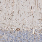 Immunohistochemical staining of human cerebellum shows strong cytoplasmic positivity in Purkinje cells.