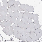 Immunohistochemical staining of human skeletal muscle shows no positivity in myocytes as expected.