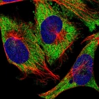 Immunofluorescent staining of human cell line U-251 MG shows localization to cytosol.