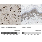 Anti-G3BP2 Antibody