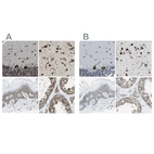 Immunohistochemical staining of human cerebellum, cerebral cortex, skin and testis using Anti-G3BP2 antibody HPA018304 (A) shows similar protein distribution across tissues to independent antibody HPA018425 (B).