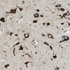Immunohistochemical staining of human cerebral cortex shows strong cytoplasmic positivity in neuronal cells.