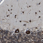 Immunohistochemical staining of human cerebellum shows strong cytoplasmic positivity in Purkinje cells and cells in molecular layer.