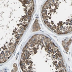 Immunohistochemical staining of human testis shows strong cytoplasmic positivity in cells in seminiferous ducts and Leydig cells.