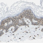 Immunohistochemical staining of human skin shows weak cytoplasmic positivity in epidermal cells.