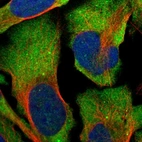 Immunofluorescent staining of human cell line U-2 OS shows localization to cytosol.