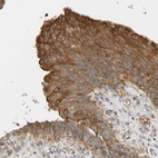 Anti-CEP57 Antibody