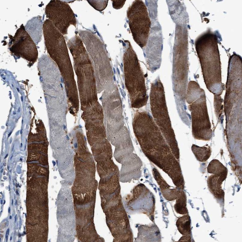 Anti-RWDD2B Antibody