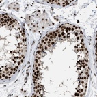 Immunohistochemical staining of human testis shows high expression.