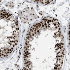 Immunohistochemical staining of human testis shows high expression.