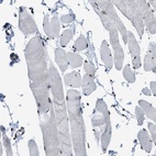 Immunohistochemical staining of human skeletal muscle shows low expression as expected.