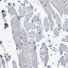 Immunohistochemical staining of human skeletal muscle shows low expression as expected.