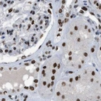 Immunohistochemical staining of human kidney using Anti-SCAF4 antibody HPA018319.
