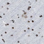 Immunohistochemical staining of human cerebral cortex using Anti-SCAF4 antibody HPA018319.