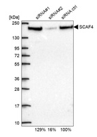 Western blot analysis in U2OS cells transfected with control siRNA, target specific siRNA probe #1 and #2, using Anti-SCAF4 antibody. Remaining relative intensity is presented.