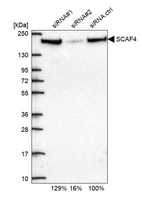 Western blot analysis in U2OS cells transfected with control siRNA, target specific siRNA probe #1 and #2, using Anti-SCAF4 antibody. Remaining relative intensity is presented.