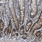 Immunohistochemical staining of human duodenum shows strong nuclear positivity in a subset of glandular cells.