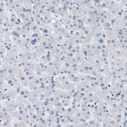 Immunohistochemical staining of human liver shows no positivity in hepatocytes as expected.