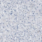 Immunohistochemical staining of human liver shows no positivity in hepatocytes as expected.