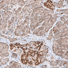 Immunohistochemical staining of human pancreas shows nuclear positivity in islets of Langerhans.