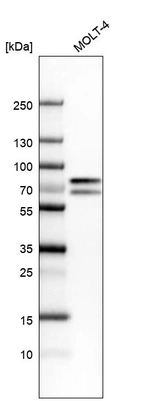 Western blot analysis in human cell line MOLT-4.