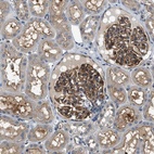 Anti-CBLB Antibody