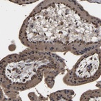 Anti-ZNF26 Antibody