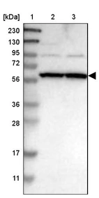 Lane 1: Marker [kDa] 230, 130, 95, 72, 56, 36, 28, 17, 11_br/_Lane 2: Human cell line RT-4_br/_Lane 3: Human cell line U-251MG sp