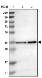 Lane 1: Marker [kDa] 230, 130, 95, 72, 56, 36, 28, 17, 11_br/_Lane 2: Human cell line RT-4_br/_Lane 3: Human cell line U-251MG sp