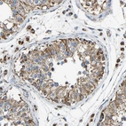 Immunohistochemical staining of human testis shows strong cytoplasmic positivity in cells in seminiferous ducts and in Leydig cells.