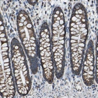 Immunohistochemical staining of human colon shows strong cytoplasmic positivity in glandular cells.