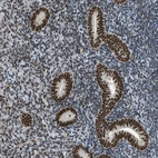 Anti-URB1 Antibody