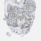 Immunohistochemical staining of human skin shows strong positivity in nucleoli and nucleus in squamous epithelial cells.