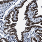 Immunohistochemical staining of human fallopian tube shows nuclear positivity in glandular cells.