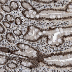 Immunohistochemical staining of human duodenum shows strong nuclear positivity in glandular cells.