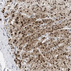 Anti-NUP35 Antibody