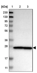 Lane 1: Marker [kDa] 230, 130, 95, 72, 56, 36, 28, 17, 11_br/_Lane 2: Human cell line RT-4_br/_Lane 3: Human cell line U-251MG sp