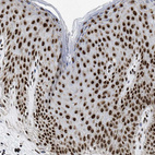 Immunohistochemical staining of human skin shows strong nuclear positivity in squamous epithelial cells.