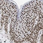 Immunohistochemical staining of human skin shows strong nuclear positivity in squamous epithelial cells.