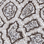 Immunohistochemical staining of human small intestine shows strong nuclear positivity in glandular cells.