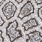 Immunohistochemical staining of human small intestine shows strong nuclear positivity in glandular cells.